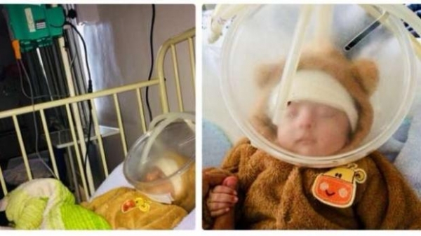  Tcharlie nasceu com Síndrome de Edwards. (Foto: Divulgação)