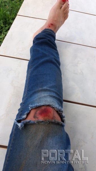 A calça jeans ficou rasgada na queda. (Foto: Portal Nova Santa Rosa)