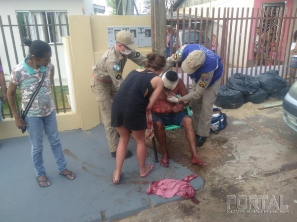 Fotos: Bogoni Radar B.O