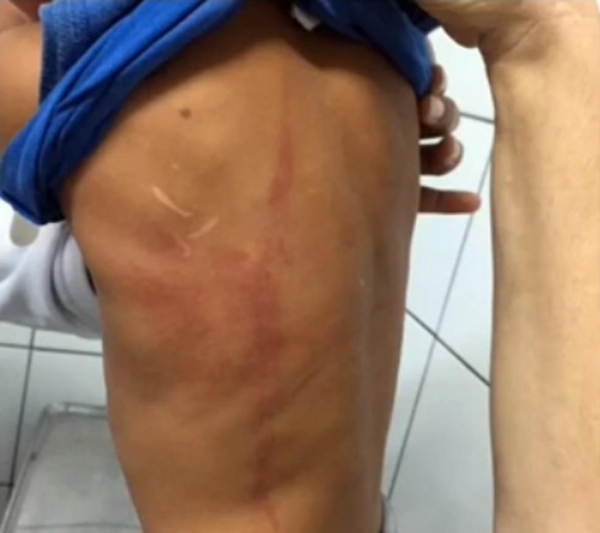 Fotos feitas pelo conselho mostram que o menino possui machucados e cicatrizes no corpo. – Reprodução RPC