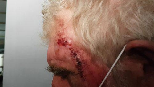 A vítima estava com um corte na cabeça, além de outras contusões e escoriações pelo corpo.(Foto: CGN)