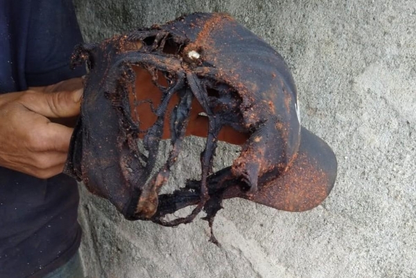 Homem é atingido na cabeça por raio enquanto trabalhava em obra no Paraná — Foto: Foto Autorizada/Arquivo Pessoal