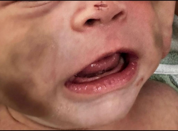 Imagens da criança agredida. Foto: PCPR