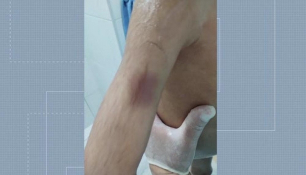 Machucados identificados na criança de apenas 4 anos — Foto: Reprodução