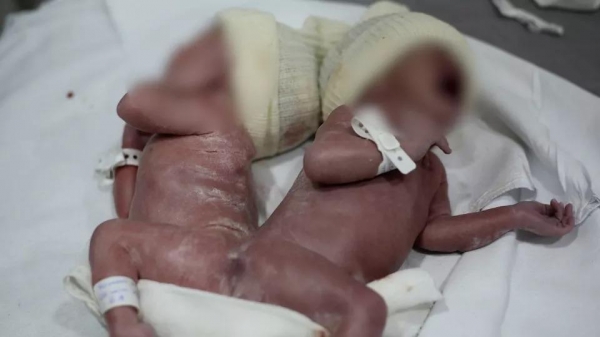 Foto: Reprodução/Hospital do Rocio