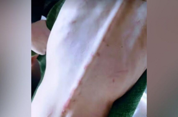 Mãe é presa suspeita de agredir e manter filha com esquizofrenia amarrada e desnutrida — Foto: Polícia Civil