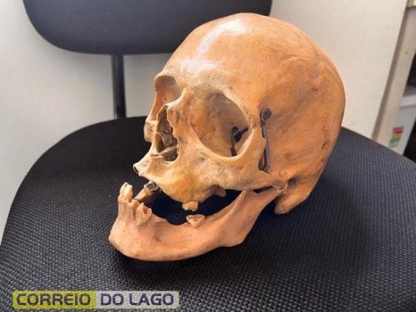 Crânio humano encontrado. Foto: Correio do Lago.