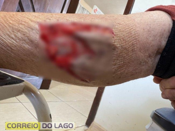 Fotos: Correio do Lago