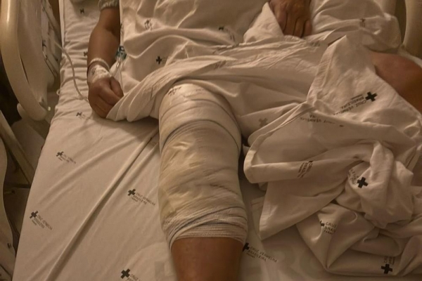 Idosa de 72 anos teve joelho errado operado em hospital particular de Curitiba. — Foto: Foto: Arquivo Pessoal